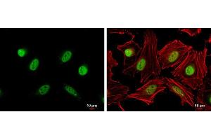ICC/IF Image Cyclin A2 antibody detects Cyclin A2 protein at nucleus by immunofluorescent analysis. (Cyclin A anticorps  (C-Term))