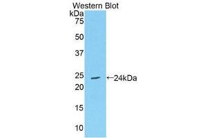Western Blotting (WB) image for anti-TIMP Metallopeptidase Inhibitor 4 (TIMP4) (AA 40-224) antibody (ABIN1172388) (TIMP4 anticorps  (AA 40-224))