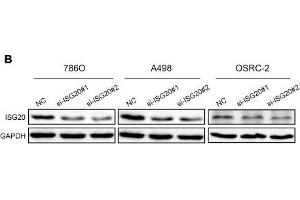 ISG20 promoted ccRCC cell proliferation in vitro. (GAPDH anticorps)
