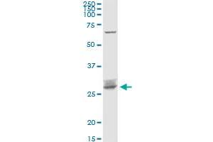ARHGDIB MaxPab rabbit polyclonal antibody. (ARHGDIB anticorps  (AA 1-201))