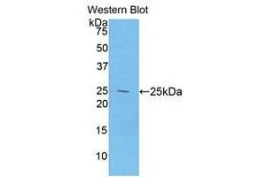 Western Blotting (WB) image for anti-Desmocollin 1 (DSC1) (AA 486-686) antibody (ABIN1858667) (Desmocollin 1 anticorps  (AA 486-686))