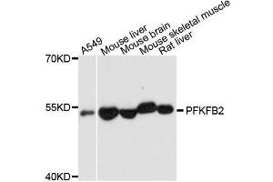 PFKFB2 antibody  (AA 446-505)