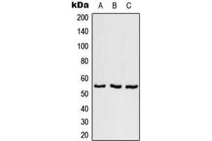 Western blot analysis of SFRS11 expression in NCI-H292 (A), SP2/0 (B), H9C2 (C) whole cell lysates.