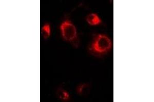 Immunofluorescent analysis of GRASP65 staining in A549 cells. (GORASP1 anticorps)