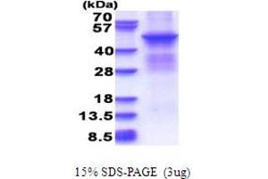 SDS-PAGE (SDS) image for Protein Kinase, CAMP Dependent, Catalytic, beta (PRKACB) (AA 1-398) protein (His tag) (ABIN5853686)