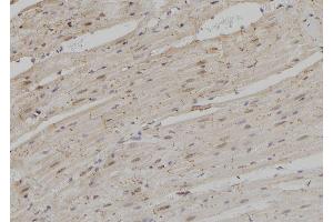 ABIN6279037 at 1/100 staining Rat heart tissue by IHC-P. (RPS3A anticorps  (C-Term))