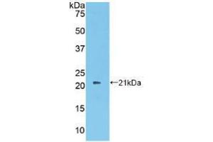 Western blot analysis of recombinant Human PROS. (PROS1 anticorps  (AA 481-667))