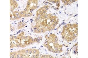 Immunohistochemistry of paraffin-embedded Human kidney using RPS4X Polyclonal Antibody at dilution of 1:100 (40x lens). (RPS4X anticorps)