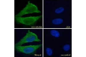ABIN185659 Immunofluorescence analysis of paraformaldehyde fixed HeLa cells, permeabilized with 0.