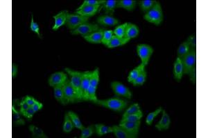 Immunofluorescence staining of HepG2 cells with ABIN7157520 at 1:100, counter-stained with DAPI. (KIR2DS5 anticorps  (AA 162-242))