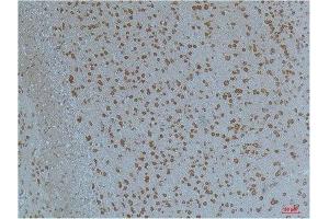 Immunohistochemistry (IHC) analysis of paraffin-embedded Mouse Brain Tissue using Kv11. (KCNH2 anticorps)