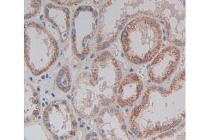 Used in DAB staining on fromalin fixed paraffin- embedded kidney tissue (TRAPPC10 anticorps  (AA 74-357))