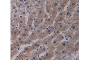 Used in DAB staining on fromalin fixed paraffin- embedded Kidney tissue (RND1 anticorps  (AA 1-229))
