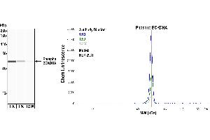Western Blotting (WB) image for anti-Branched Chain Keto Acid Dehydrogenase E1, alpha Polypeptide (BCKDHA) (pSer292) antibody (ABIN7449282) (Recombinant BCKDHA anticorps  (pSer292))