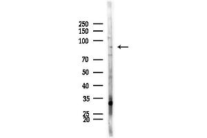 Western blot analysis of lysates from HepG2 cells(LPS, 4h treatment), using PTP alpha Antibody at 1/1000 dilution.