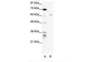 Image no. 1 for anti-IKAROS Family Zinc Finger 4 (Eos) (IKZF4) (AA 97-146) antibody (ABIN202738) (IKZF4 anticorps  (AA 97-146))