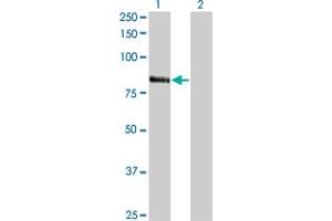 Western Blot analysis of RNF103 expression in transfected 293T cell line by RNF103 monoclonal antibody (M01), clone 3E7. (RNF103 anticorps  (AA 501-599))
