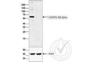 Image provided by the Independent Validation Program (badge number 29759). (Caspase 8 anticorps  (AA 411-482))