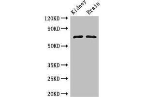 Western Blot Positive WB detected in: Mouse kidney tissue, Mouse brain tissue All lanes: GAA Antibody at 3 μg/mL Secondary Goat polyclonal to rabbit IgG at 1/50000 dilution Predicted band size: 70, 76, 106 kDa Observed band size: 70 kDa (GAA anticorps  (AA 601-952))