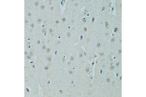 Immunohistochemistry of paraffin-embedded rat brain using ZNF346 antibody (ABIN5975303) at dilution of 1/100 (40x lens). (ZNF346 anticorps)