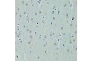 Immunohistochemistry of paraffin-embedded rat brain using ZNF346 antibody (ABIN5975303) at dilution of 1/100 (40x lens). (ZNF346 anticorps)