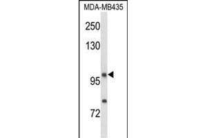 Western blot analysis of NRP1 Antibody (C-term) (ABIN653013 and ABIN2842638) in MDA-M cell line lysates (35 μg/lane). (Neuropilin 1 anticorps  (C-Term))