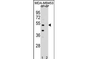 Western blot analysis of WDR51B Antibody (C-term) Pab (ABIN654969 and ABIN2844607) pre-incubated without(lane 1) and with(lane 2) blocking peptide in MDA-M cell line lysate. (POC1B anticorps  (C-Term))