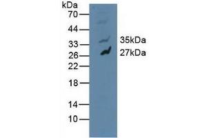 Detection of MAPK10 in Human U-87MG Cells using Polyclonal Antibody to Mitogen Activated Protein Kinase 10 (MAPK10) (MAPK10 anticorps  (AA 88-332))