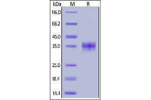 Mouse Siglec-15, His Tag on  under reducing (R) condition. (SIGLEC15 Protein (AA 24-262) (His tag))