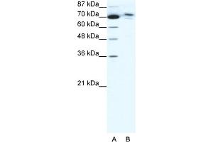 WB Suggested Anti-C14ORF101 Antibody Titration:  0. (C14orf101 anticorps  (N-Term))