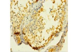 Immunohistochemistry of paraffin-embedded human testis tissue using ABIN7175117 at dilution of 1:100 (UCK1 anticorps  (AA 1-201))