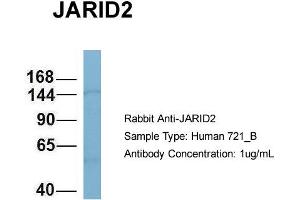 Host: Rabbit Target Name: JARID2 Sample Type: 721_B Antibody Dilution: 1. (JARID2 anticorps  (N-Term))