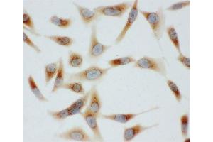 ICC testing of BiP antibody and HeLa cells