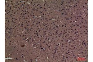 Immunohistochemistry (IHC) analysis of paraffin-embedded Rat Brain, antibody was diluted at 1:100.