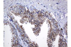 Image no. 6 for anti-NADH Dehydrogenase (Ubiquinone) 1 beta Subcomplex, 10, 22kDa (NDUFB10) antibody (ABIN1499672) (NDUFB10 anticorps)