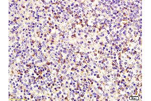 Formalin-fixed and paraffin embedded human spleen labeled with Anti CD75 Polyclonal Antibody, Unconjugated (ABIN704201) at 1:200 followed by conjugation to the secondary antibody and DAB staining. (ST6GAL1 anticorps  (AA 301-406))