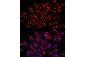 Immunohistochemistry of paraffin-embedded rat heart using SERC/ Rabbit pAb (ABIN3021429, ABIN3021430, ABIN3021431 and ABIN6215028) at dilution of 1:150 (40x lens).