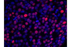 Immunofluorescence (IF) image for anti-Nuclear Casein Kinase and Cyclin-Dependent Kinase Substrate 1 (NUCKS1) (AA 1-50) antibody (ABIN7448993) (NUCKS1 anticorps  (AA 1-50))