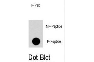 Dot Blot (DB) image for anti-Regulator of G-Protein Signalling 19 (RGS19) (pSer24) antibody (ABIN2971001) (RGS19 anticorps  (pSer24))