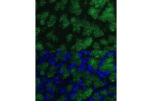 Immunofluorescence analysis of rat pancreas using CTRB1 Polyclonal Antibody (ABIN7266398) at dilution of 1:100 (40x lens).