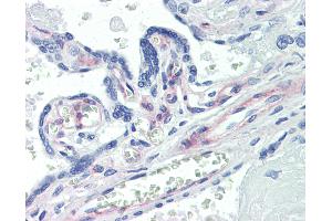 Anti-PDGFRB antibody IHC of human placenta. (PDGFRB anticorps)
