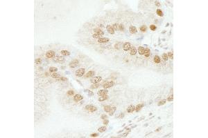 Immunohistochemistry (IHC) image for anti-SWI/SNF Related, Matrix Associated, Actin Dependent Regulator of Chromatin, Subfamily B, Member 1 (SMARCB1) (AA 75-125) antibody (ABIN7448800)