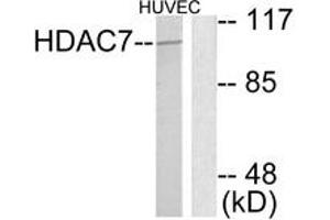 Western blot analysis of extracts from HuvEc cells, using HDAC7 Antibody. (HDAC7 anticorps  (AA 901-950))