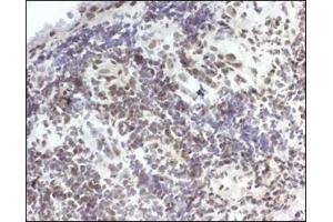 Image no. 3 for anti-Hydroxyprostaglandin Dehydrogenase 15-(NAD) (HPGD) antibody (ABIN363465)