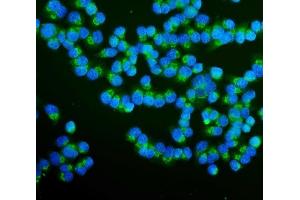 IF analysis of RAB1B using anti-RAB1B antibody (ABIN7602809). (RAB1B anticorps  (C-Term))