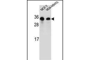 SAR1B Antibody (Center) (ABIN654355 and ABIN2844120) western blot analysis in MCF-7,MDA-M cell line lysates (35 μg/lane). (SAR1B anticorps  (AA 89-116))