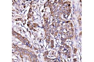 IHC analysis of ORP150/HYOU1 using anti-ORP150/HYOU1 antibody (ABIN7601807).