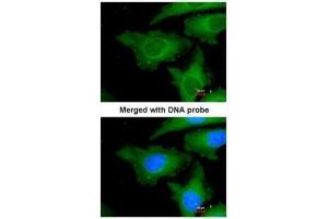 anti-Ubiquitin-Conjugating Enzyme E2L 3 (UBE2L3) (C-Term) antibody