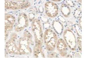 IHC-P analysis of Human Kidney Tissue, with DAB staining. (ANTXR2 anticorps  (AA 34-318))