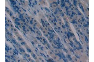 DAB staining on IHC-P; Samples: Mouse Stomach Tissue